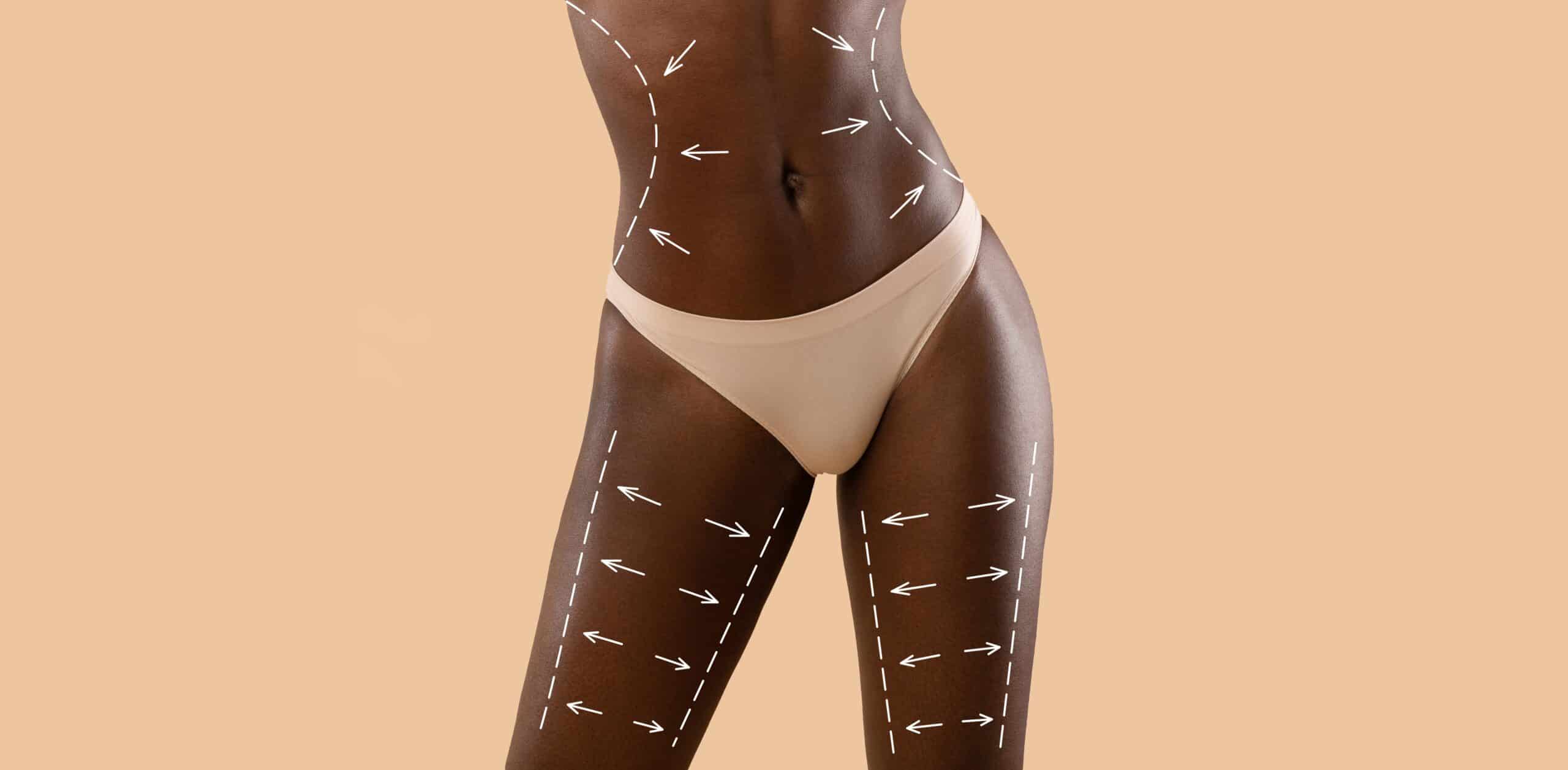 You are currently viewing Find Your Fit: Body Sculpting